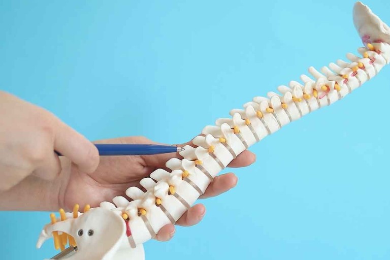 Slipped Discs and Chiropractic Care