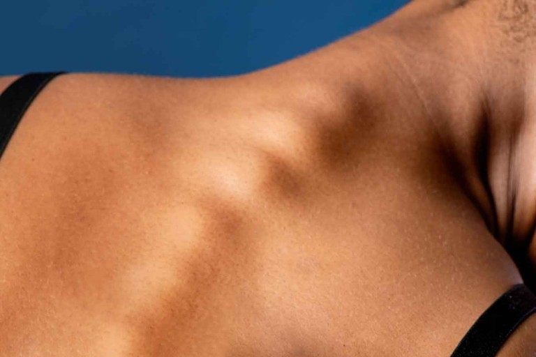 Understanding Vertebral Subluxation and the Benefits of Upper Cervical Chiropractic Care